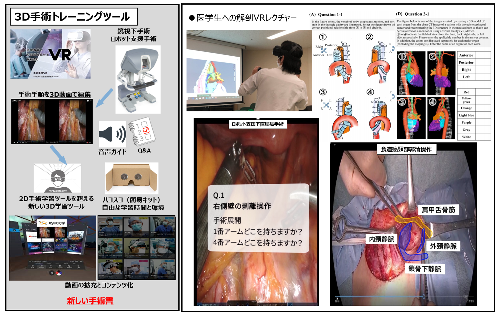 AR解剖アプリ