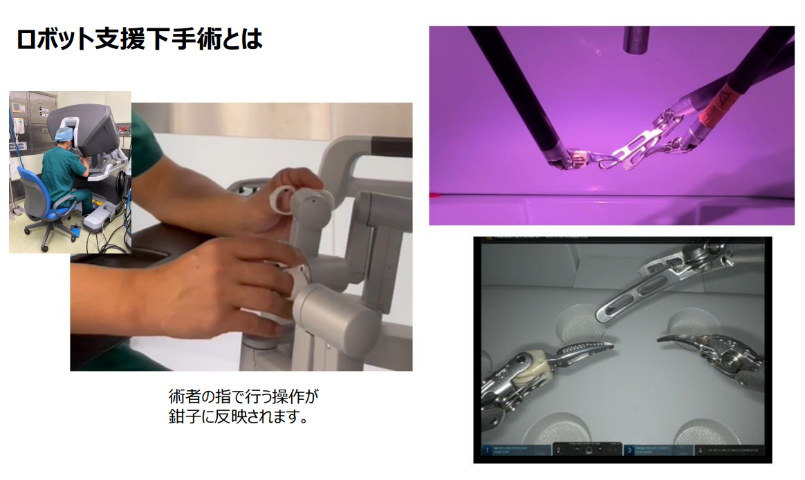 ロボット支援下手術の導入と現状