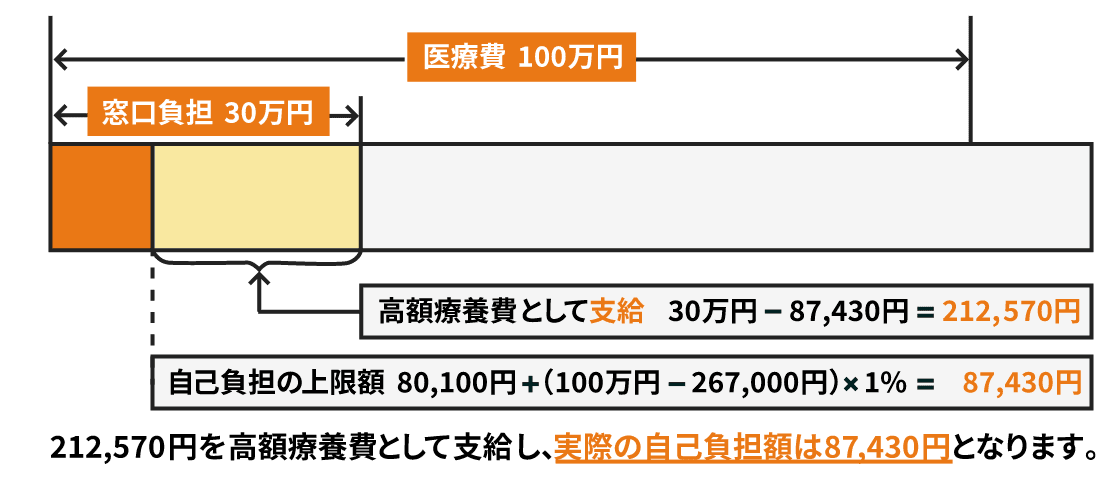 医療費100万円 窓口負担30万円 高額治療費として支給（30万円 - 87,430円 = 212,570円） 自己負担の上限額（80,100円 + （100万円 - 267,000円）✕ 1% = 87,430円） 212,570円を高額医療費として支給し、実際の自己負担額は87,430円となります。